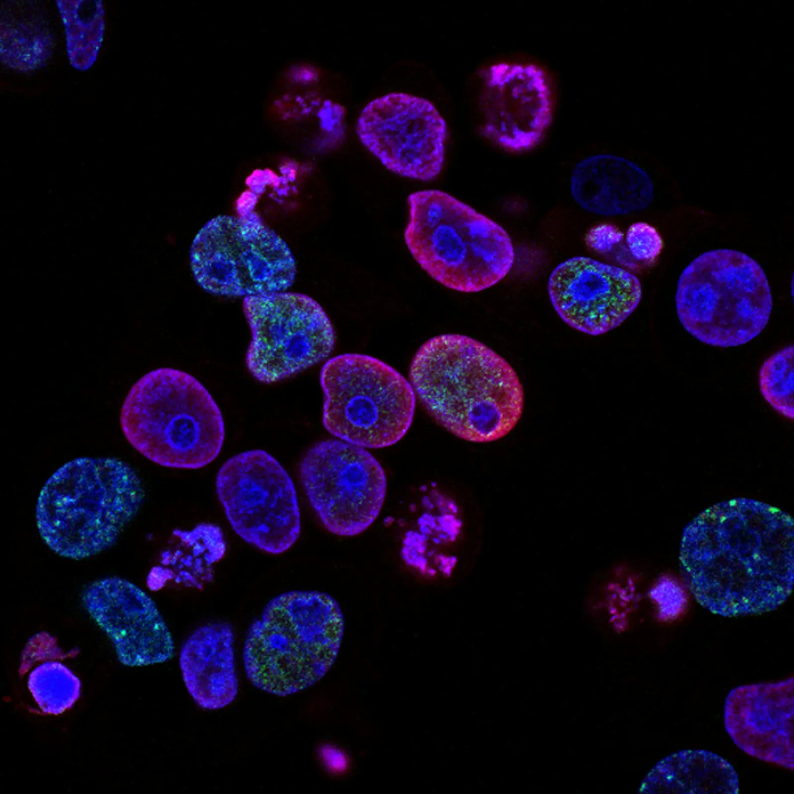 Confocal microscopy of stained cells